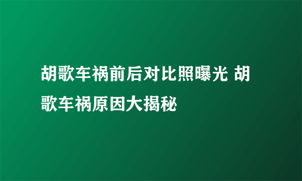 胡歌车祸前后对比照曝光 胡歌车祸原因大揭秘