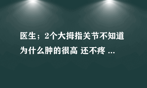 医生；2个大拇指关节不知道为什么肿的很高 还不疼 这是...