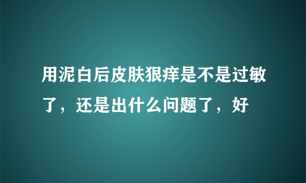 用泥白后皮肤狠痒是不是过敏了，还是出什么问题了，好