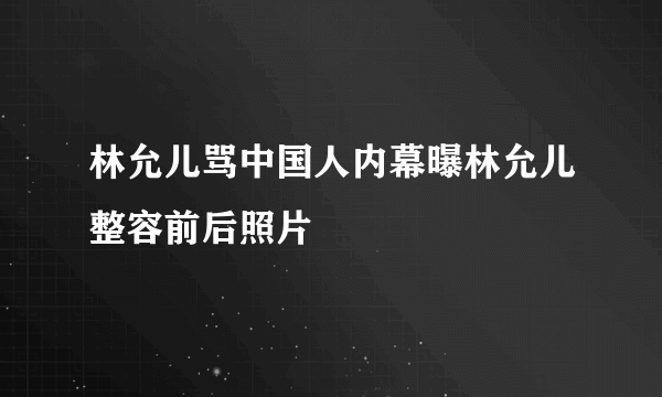 林允儿骂中国人内幕曝林允儿整容前后照片