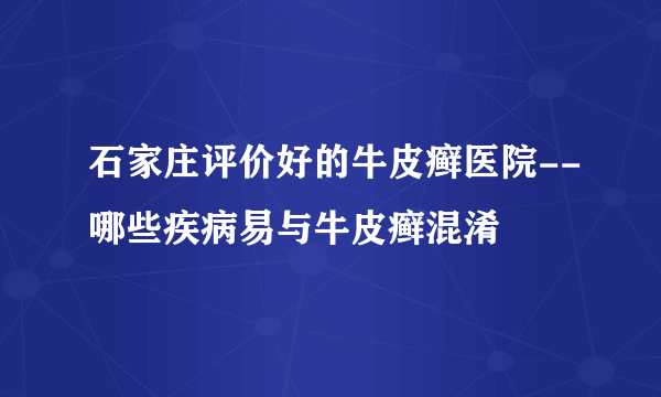 石家庄评价好的牛皮癣医院--哪些疾病易与牛皮癣混淆