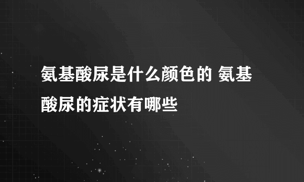 氨基酸尿是什么颜色的 氨基酸尿的症状有哪些