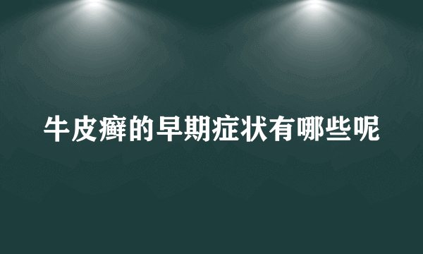 牛皮癣的早期症状有哪些呢