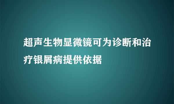 超声生物显微镜可为诊断和治疗银屑病提供依据