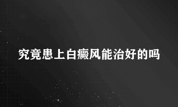 究竟患上白癜风能治好的吗