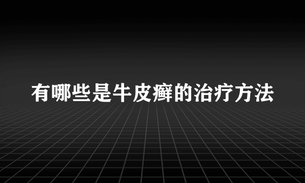 有哪些是牛皮癣的治疗方法