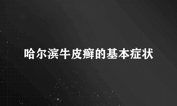 哈尔滨牛皮癣的基本症状