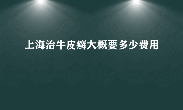 上海治牛皮癣大概要多少费用