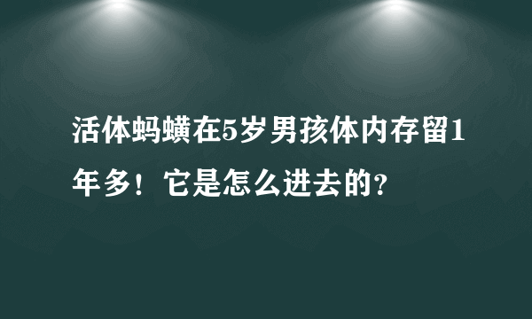 活体蚂蟥在5岁男孩体内存留1年多！它是怎么进去的？