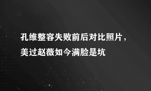 孔维整容失败前后对比照片，美过赵薇如今满脸是坑 