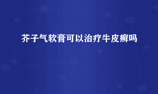 芥子气软膏可以治疗牛皮癣吗