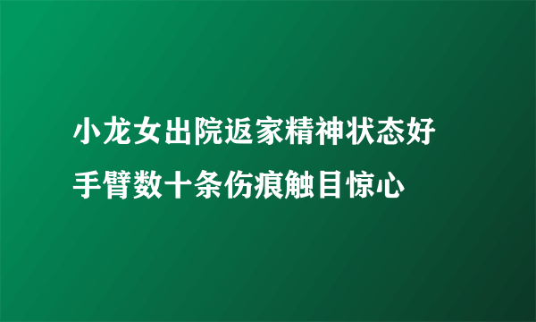 小龙女出院返家精神状态好 手臂数十条伤痕触目惊心