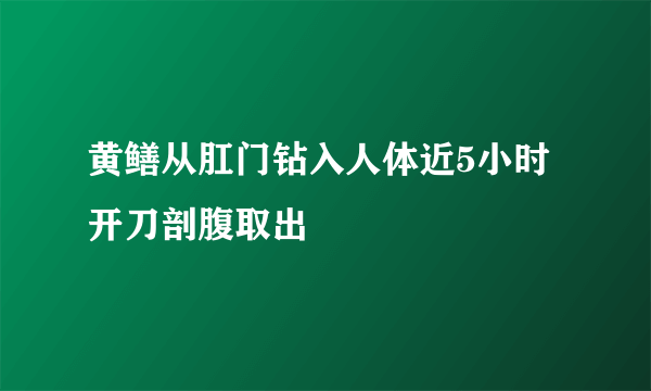 黄鳝从肛门钻入人体近5小时 开刀剖腹取出