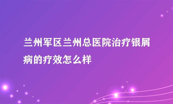 兰州军区兰州总医院治疗银屑病的疗效怎么样