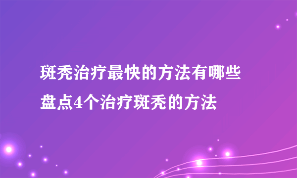 斑秃治疗最快的方法有哪些 盘点4个治疗斑秃的方法