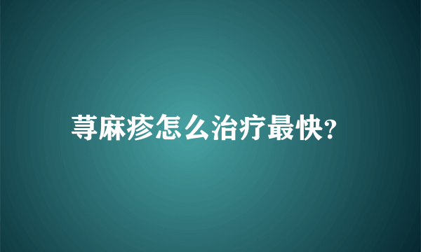 荨麻疹怎么治疗最快？