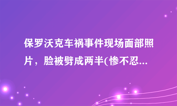 保罗沃克车祸事件现场面部照片，脸被劈成两半(惨不忍睹)—飞外