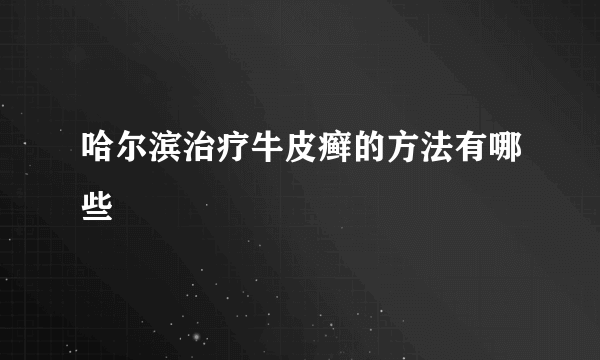 哈尔滨治疗牛皮癣的方法有哪些