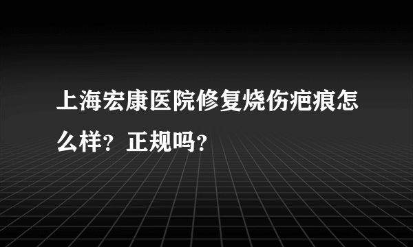 上海宏康医院修复烧伤疤痕怎么样？正规吗？