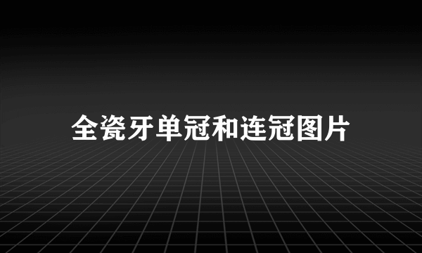 全瓷牙单冠和连冠图片