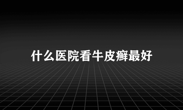 什么医院看牛皮癣最好