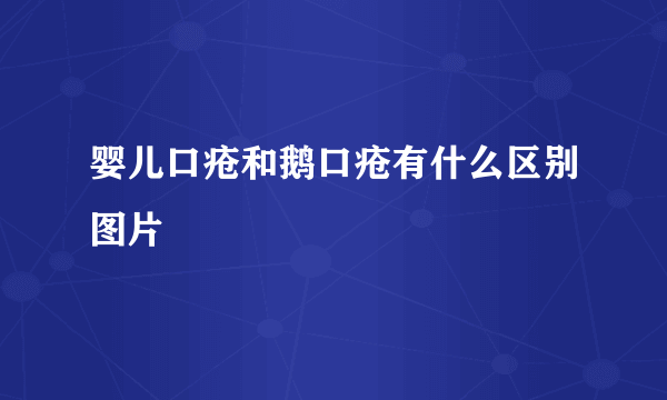 婴儿口疮和鹅口疮有什么区别图片