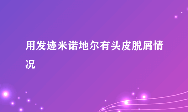 用发迹米诺地尔有头皮脱屑情况